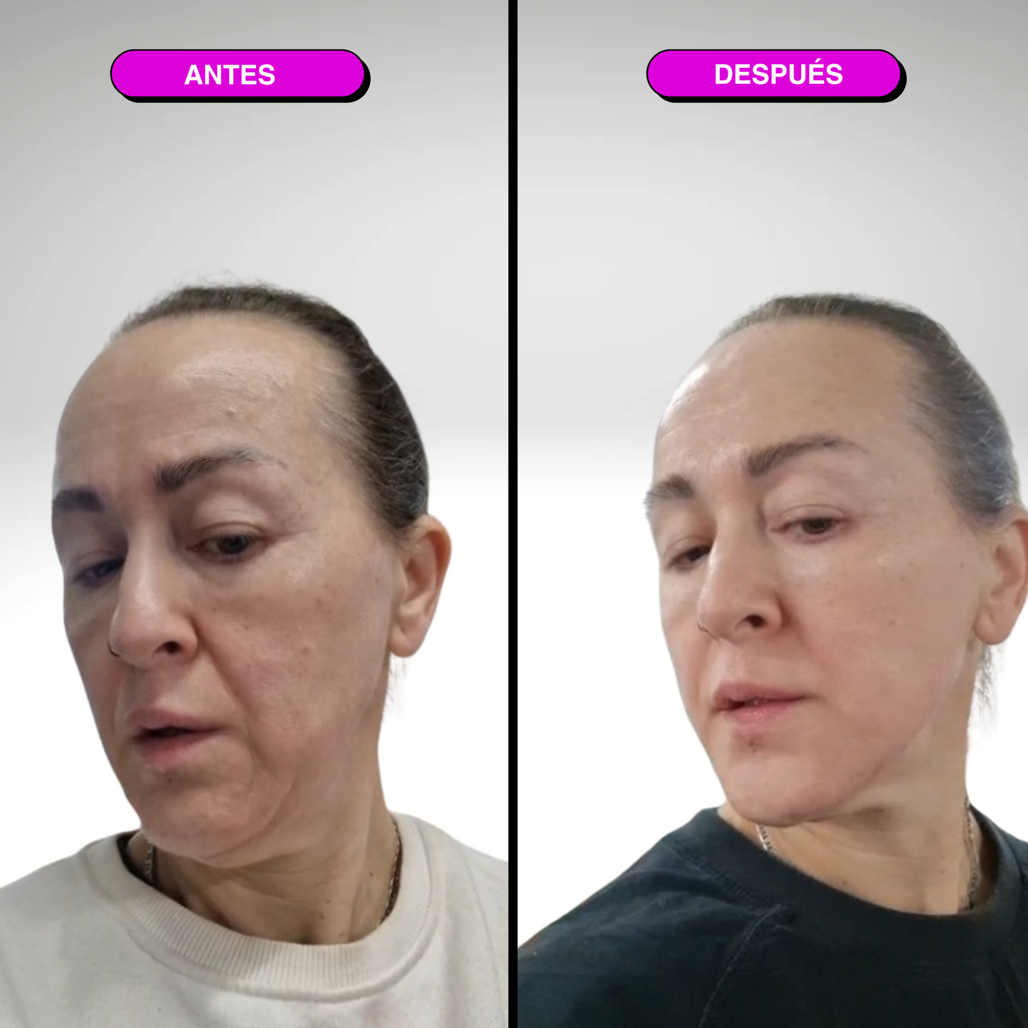 CALIA Masajeador Facial LED 7 en 1